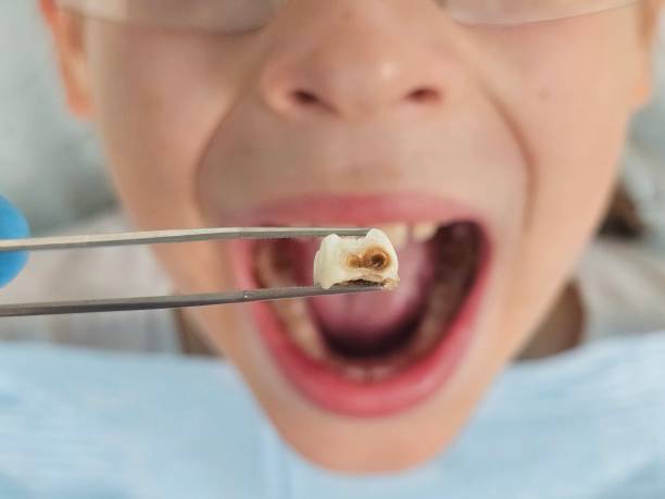 Best Urgent Dental Care for Toothaches in Dumas, AR